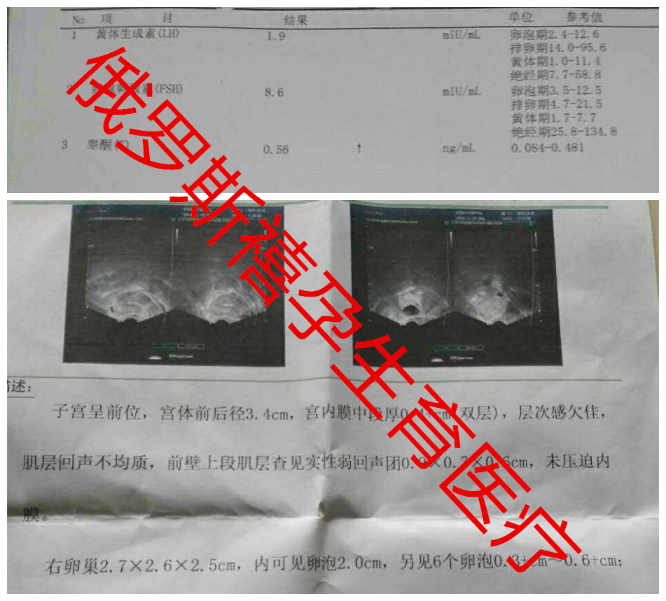 禧孕NGC俄罗斯试管婴儿如何解决胎停困扰