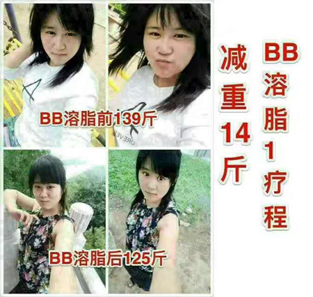 BB溶脂纯中药胶囊减肥效果怎么样，有没有副作用？会不会反弹？