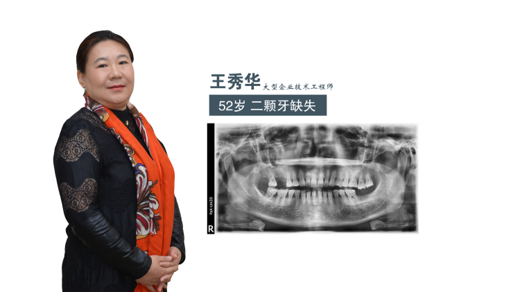 廊坊电视台第三季种植牙直播即将上演！！！