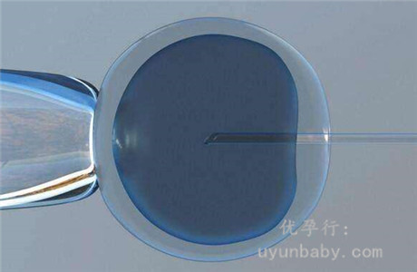 美国试管婴儿医院哪家好？选对医院成功率翻倍