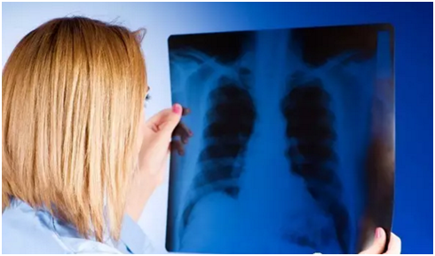 【肺癌帮分享】预防肺癌10大重点不止戒烟