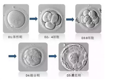 美国试管婴儿技术 移植囊胚还是卵裂期胚胎