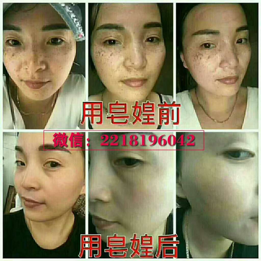 满婷致尊皂媓怎么代理？联系方式，效果怎么样？总代静静