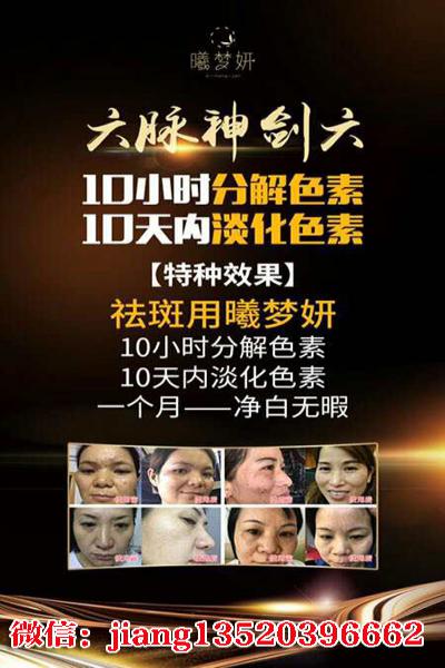 曦梦妍童妍亮肤套装代理价格？代理条件