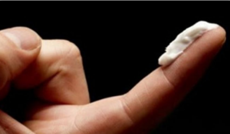 铜钱癣好治疗吗，用了这个见效最快