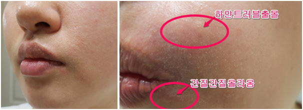 除角质推荐韩国热门半月面膜