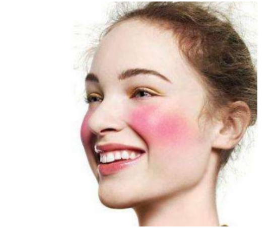 脸上红血丝，食物也能帮你去除