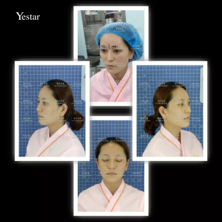 Yestar南京艺星美丽盛典，带您走向变美之路